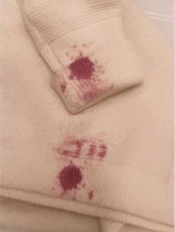 Concentrate Results: Clothing Stains Before - Card 2 - View 2